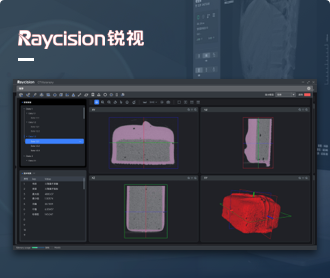 銳視醫(yī)療CT分析軟件界?設(shè)計(jì)